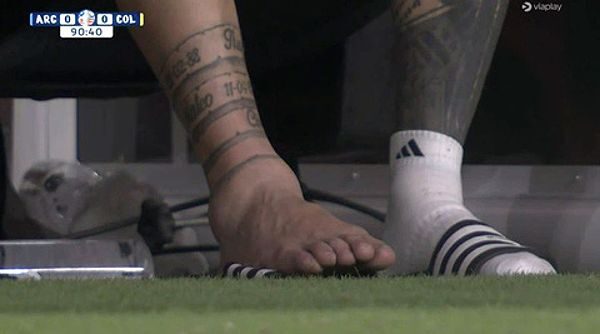 Cổ chân Messi sưng phù trong trận đấu
